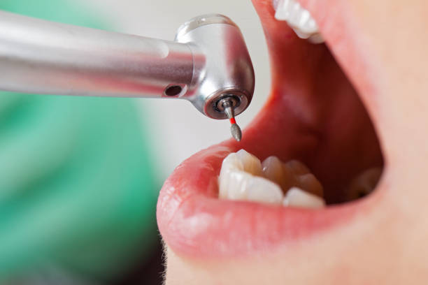 Emergency Gum Pain Relief in CT